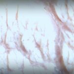 Cholesterin: Fakten über verbreitete Mythen