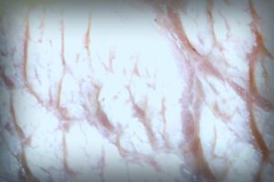 Cholesterin: Fakten über verbreitete Mythen