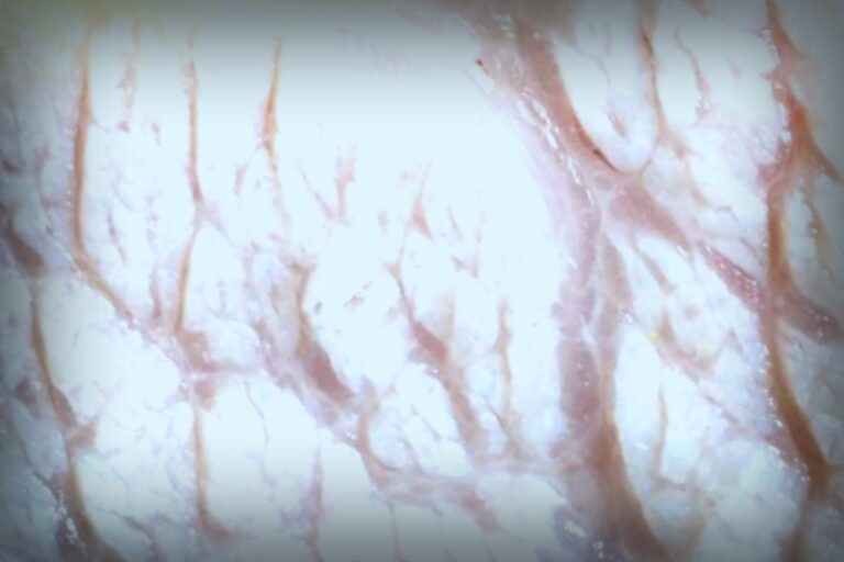 Cholesterin: Fakten über verbreitete Mythen