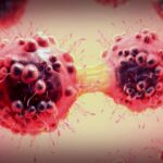 Zunehmende Krebsdiagnosen bei jungen Erwachsenen: Ursachen und Lösungen